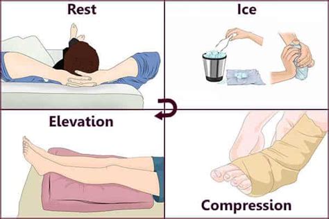 compression test elevation|rice for ankle injury.